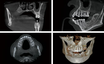 PreVista i3D