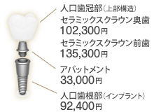 スタンダードインプラント