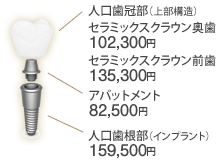 スペシャルインプラント